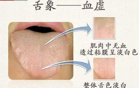 收藏！舌头看健康，这11种舌象各自代表的疾病，你都知道吗？