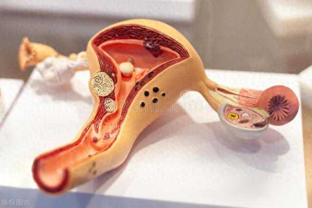 6大症状提醒你，女人的卵巢能不能生育，备孕的你赶紧收藏起！